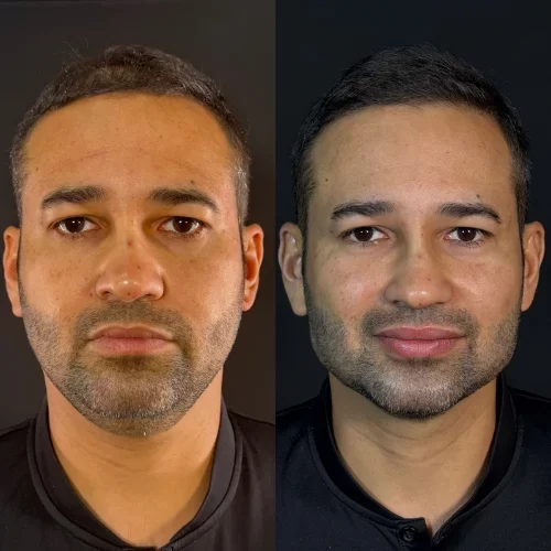 Design sem nome (19)